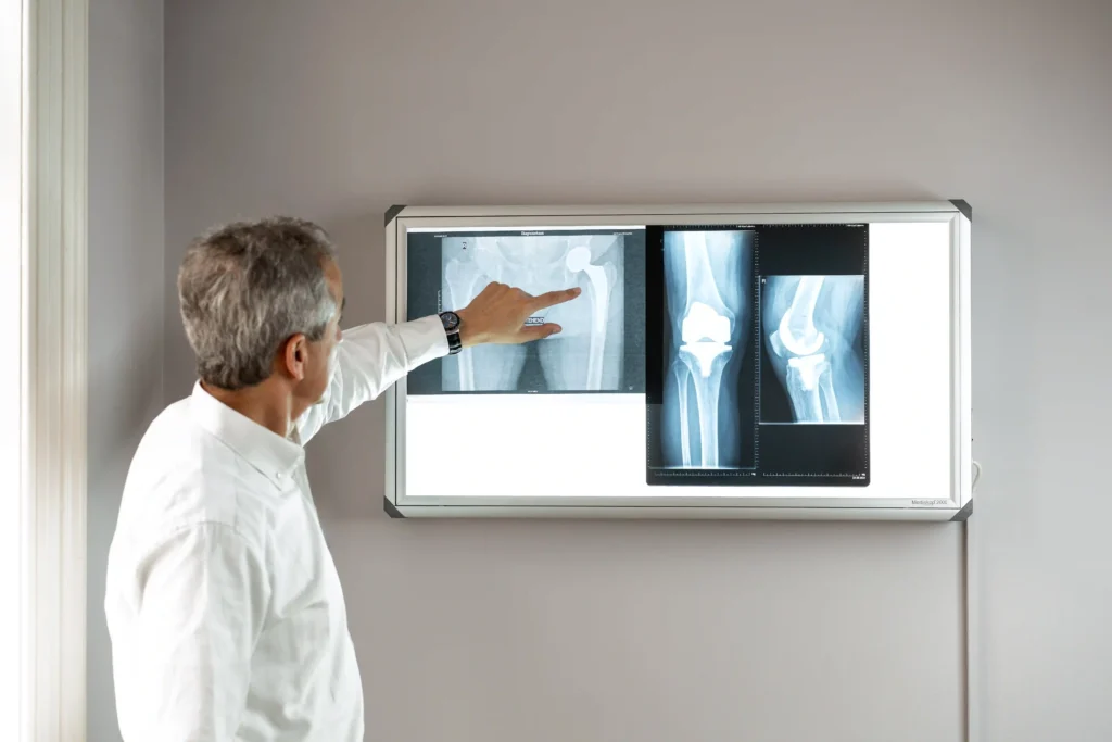 Orthopädischer Facharzt Dr. Lukas Karamat zeigt auf Hüft- und Knie-Röntgenbilder bei der Besprechung eines Befundes.